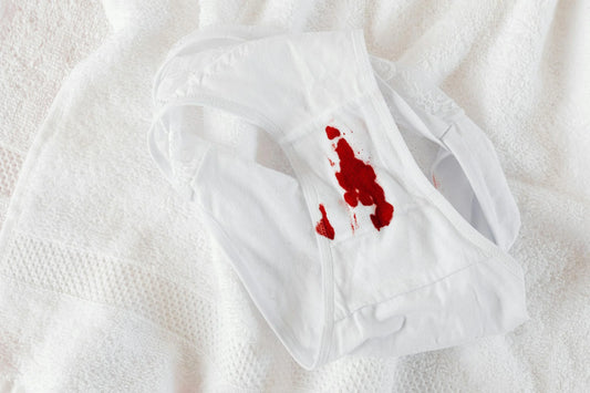 Tips of How to Remove Period Stains-- Ultimate Guide